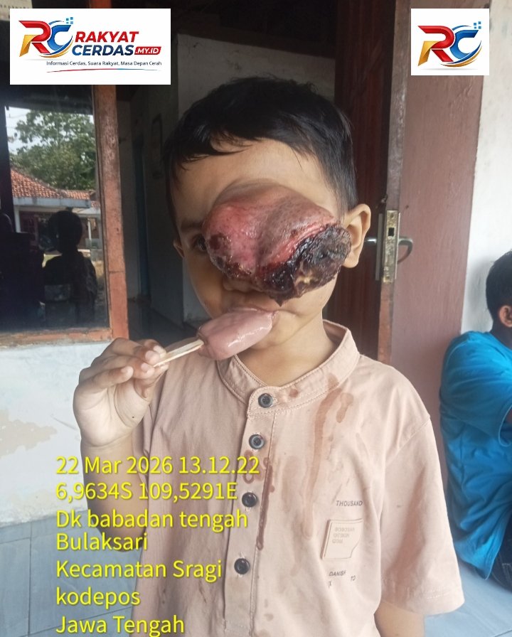 Perjuangan Kenzo (4) Belum Usai, Tumor Tumbuh Kembali Usai Operasi, Keluarga Harap Bantuan Pemerintah