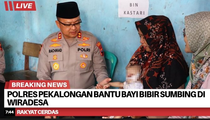 Polres Pekalongan Bantu Bayi Bibir Sumbing di Wiradesa