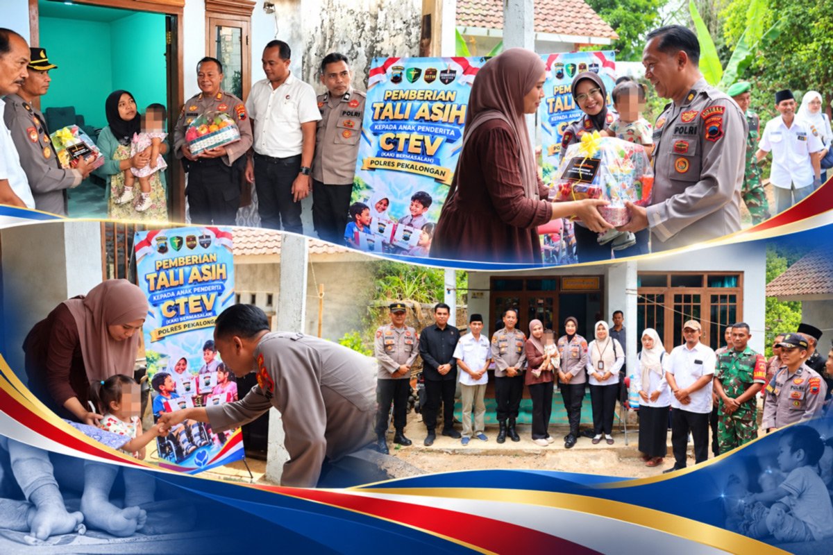 Ketika Kepedulian Datang ke Rumah: Polres Pekalongan Dampingi Dua Anak dengan Kelainan Kaki Bawaan
