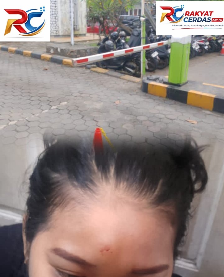 Palang Pintu Parkir Tiba-Tiba Menutup, Ibu Rumah Tangga Terpukul di Kepala di Stasiun Pekalongan