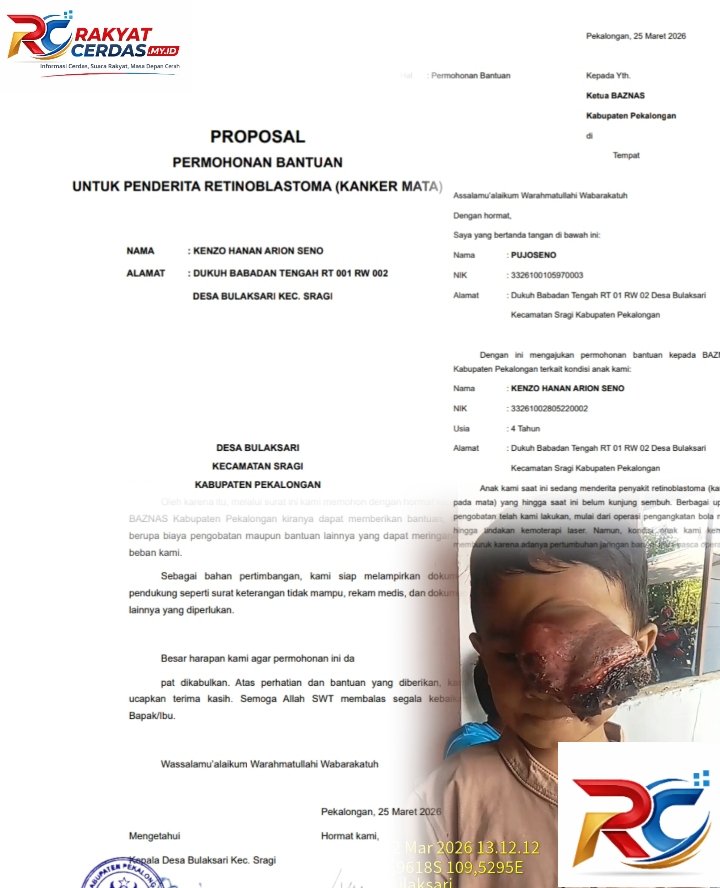 Respons Cepat Plt Bupati Pekalongan, Bantuan untuk Bocah Penderita Kanker Mata Segera Ditindaklanjuti