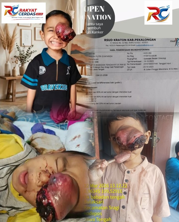 Perjuangan Ganda Ibu dan Anak di Pekalongan, Kenzo (4) Kembali Jalani Operasi di Tengah Keterbatasan